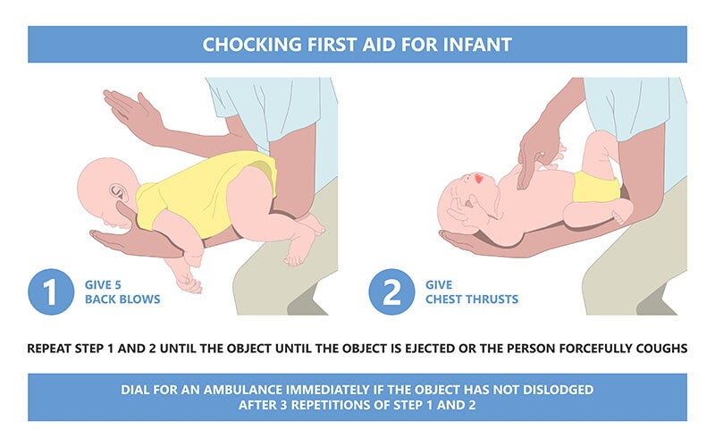 An illustration of choking first aid for infants, showing two panels for back blows and chest thrusts