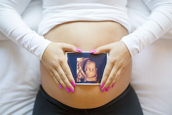 Photo of a pregnant woman’s belly with her hands on top and holding an ultrasound photo.