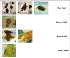Types of baby poops
