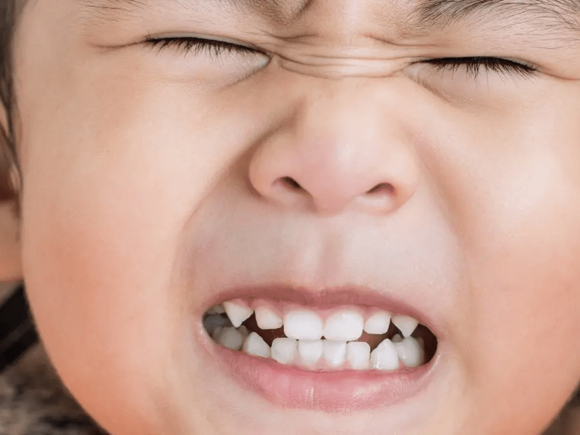 Why Is My Child Grinding Her Teeth? | Bruxism