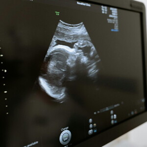 can you get pregnant from precum