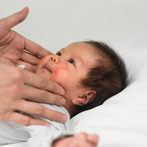 Close-up of mom’s hands checking newborn lying in bed with a baby rash on the cheeks. Close-up of mom’s hands checking newborn lying in bed with a baby rash on the cheeks.