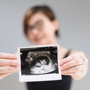 12-week-pregnant woman in the background holding a clear ultrasound scan of her fully formed baby.