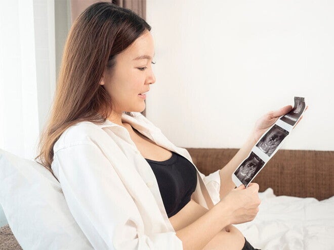 A young Asian woman in bed looking at her ultrasound at 13 weeks pregnant A young Asian woman in bed looking at her ultrasound at 13 weeks pregnant