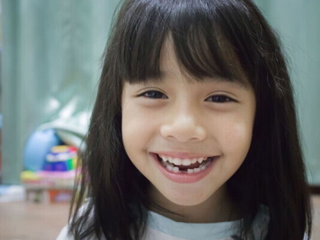 A little Asian girl smiling widely to show her teeth, which have a gap at the bottom.