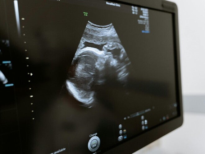 can you get pregnant from precum can you get pregnant from precum