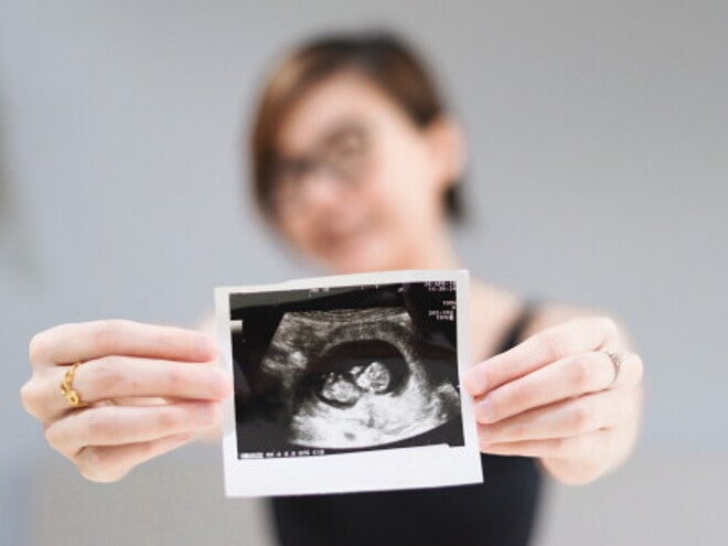 12-week-pregnant woman in the background holding a clear ultrasound scan of her fully formed baby.