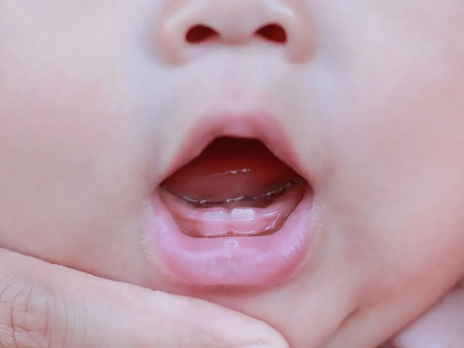 Should I Be Worried About My Baby’s Late Teething? Should I Be Worried About My Baby’s Late Teething?