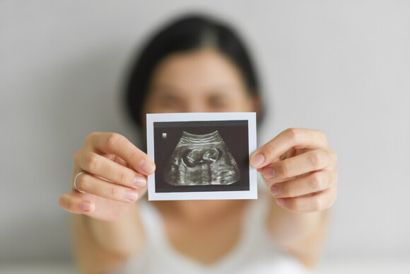 Young pregnant Filipina holds her baby’s sonogram after congenital anomaly scan. Young pregnant Filipina holds her baby’s sonogram after congenital anomaly scan.